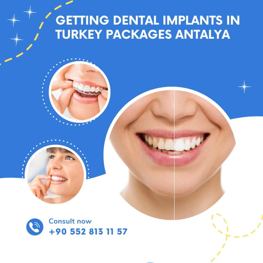 Dental Implants Turkey Package Get the Best Smile 6 Full Mouth Dental Implants Turkey Package Deals