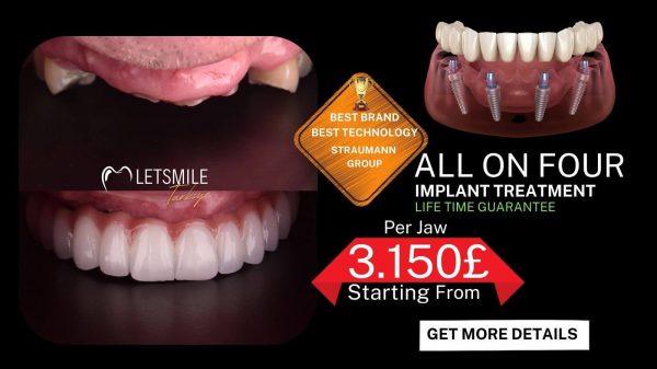 All on Four Implant Treatment in Turkey with Lifetime Guarantee - Starting at £3,150 Per Jaw. Best Brand and Technology by Straumann Group. Offered by Dental Holiday Turkey Antalya.