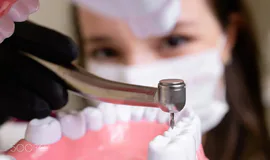 Dental Implants in Antalya Turkiye